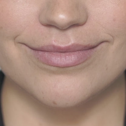 Lakerain Blading Lip Stain Peel